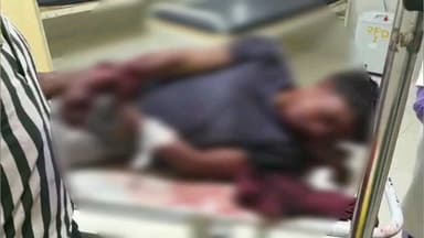 ଦେବଗଡ: ବଡବାହାଲ ନିକଟରେ ବାଇକରୁ ଖସି ପଡି କଳାମାଟି ଗ୍ରାମର ଯୁବକ ଗୁରୁତର ଆହତ