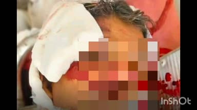 ఇల్లందు: కరకగూడెం మండల పరిధిలోని తిల్లాపురం గ్రామ సమీపంలో ద్విచక్ర వాహనంపై చెట్టును ఢీకొని ఒకరి మృతి చెందగా మరొకరికి గాయాలు