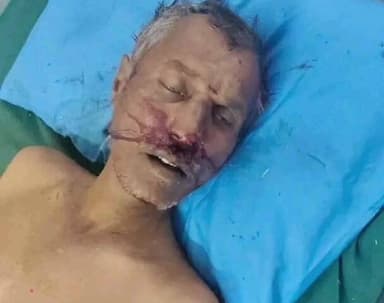 కనిగిరి: మున్సిపాలిటీ పరిధిలోని మాచవరంలో రోడ్డు ప్రమాదం, గుర్తు తెలియని వాహనం ఢీకొని ఓ వ్యక్తి అక్కడికక్కడే మృతి