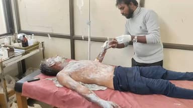 હાલોલ: હાલોલ તાલુકાના તરખંડા ગામે આધેડ ઉપર તેમની પ્રેમિકા દ્વારા ઉકળતું તેલ રેડ્યું,આધેડને સારવાર અર્થે હોસ્પિટલ ખસેડાયો