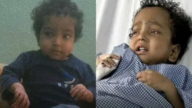 ములుగు: జిల్లాకు చెందిన బాలుడు రెండేళ్ల బాలుడు మృత్యువుతో పోరాటం