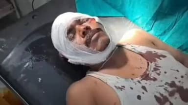 नरसिंहपुर: गुलाल लगाने पर हुआ विवाद खूनी संघर्ष में बदला, बम्हनी में एक ही परिवार के चार लोग घायल