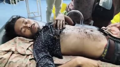 ਕਪੂਰਥਲਾ: ਘਰੇਲੂ ਝਗੜੇ ਤੋਂ ਬਾਅਦ ਵਿਅਕਤੀ ਰੇਲਵੇ ਸਟੇਸ਼ਨ ਕਪੂਰਥਲਾ ਵਿਖੇ ਬਿਜਲੀ ਦੇ ਟਾਵਰ 'ਤੇ ਚੜਿਆ-ਕਰੰਟ ਲੱਗਣ ਕਾਰਨ ਬੁਰੀ ਤਰ੍ਹਾਂ ਝੁਲਸਿਆ