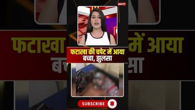 Chhattisgarh : फटाखा की चपेट में आया बच्चा, झुलसा #cgnews #chhattisgarh #janjgir_champa #patakha