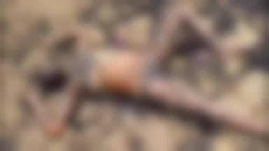 बालोद: शादी से पहले रहस्यमयी मौत: जली हालत में मिली युवती, पीएम रिपोर्ट फेल; अब फॉरेंसिक जांच से खुलेगा राज