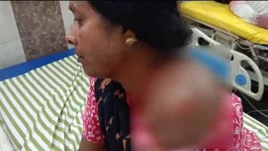 रामानुजनगर: कलयुगी पति की हैवानियत, घर से निकाली पत्नी वृद्धाश्रम पहुंची, वहां भी गड़ासे से किया जानलेवा हमला