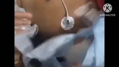 અમદાવાદ શહેર: ઇસનપુર પોલીસ સ્ટેશન વિસ્તારમાં રિક્ષામાં પેસેન્જર બેસાડવા બાબતે છરી વડે હુમલો