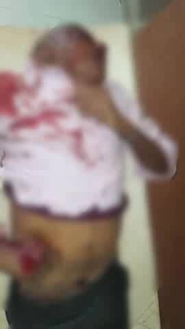 अभनपुर: अभनपुर रायपुर मुख्य मार्ग पर मोहन ढाबा के पास दो बाइक सवार आपस में टकराए, एक व्यक्ति की मौत