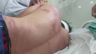 छिंदवाड़ा नगर: छिंदवाड़ा में युवक पर सनसनीखेज हमला, बंधक बनाकर पीटा, मरा समझ फेंका, अस्पताल में भर्ती