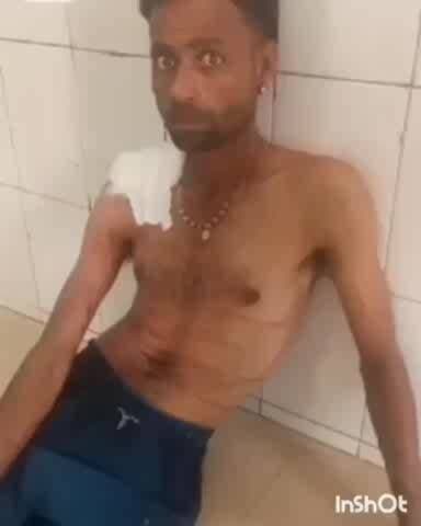 भाटपार रानी: देवरिया जिले के करौदी बाजार में ट्रैक्टर चला रहे युवक को बंदर ने काटा, युवक घायल