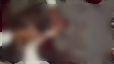 खिलचीपुर: डंपर चढ़ने से गाय घायल, दोनों पैर फ्रैक्चर, गौसेवक कर रहे हैं उपचार