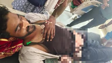 दारू: दारू के इरगा निवासी युवक की चाकूबाजी में मौत, रामनवमी जुलूस के दौरान हुआ था हमला