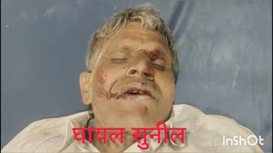 #कोसीकलां के नेशनल हाईवे पर एक गाड़ी ने तीन स्कूटी सवार में मारी जोरदार टक्कर स्कूटी सवार हुए घायल