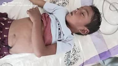 देवराज कुमार, उम्र 8वर्ष, पिता राकेश पोद्दार, घर खेना बिहना का सर्प दंश से हुई मौत