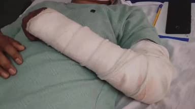 आज़मगढ़: पुलिस कर्मी लाचार, सिपाही को पाटीदारों ने बुरी तरह पीटा, जिला अस्पताल में जिंदगी की लड़ाई, व्यवस्था पर बड़ा सवाल