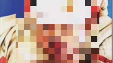 चितरंगी: चितरंगी क्षेत्र के दरवारी गांव में बेकाबू मोटरसाइकिल खंभे से टकराई, दो घायल