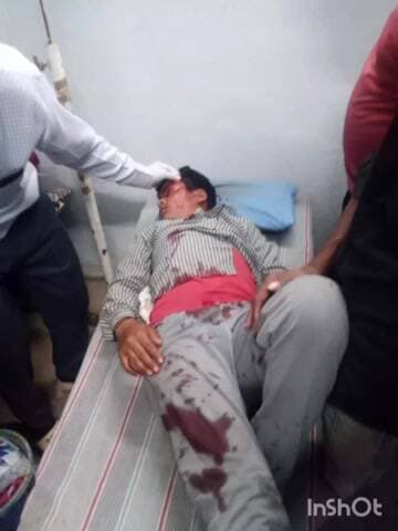 माकड़ोन: गांव सुचाई में लोडिंग वाहन ने बाइक सवार को टक्कर मारी, युवक घायल, मकड़ोंन हॉस्पिटल में उपचार जारी