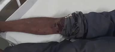 शहपुरा: कैलवारा मुड़की गांव में मोटरसाइकिल दुर्घटना, चालक घायल, शहपुरा अस्पताल में इलाज जारी