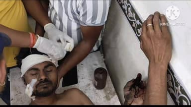 नागौद: इकरार बस्ती नागोद में युवक की आंखों में मिर्ची पाउडर डालकर तलवार से किया हमला