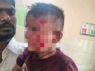 కల్వకుర్తి: కల్వకుర్తిలో వీధిశునకాల స్వైర విహారం బాలుడికి తీవ్ర గాయాలు