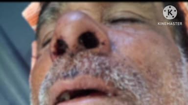 सेनगाव: पिंपरी लिग येथे रानडुकराचा हल्ला; शेतकरी गंभीर जखमी