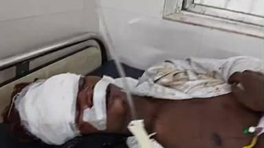 किस्को: बगड़ू मुख्य मार्ग पर सड़क हादसे में दो युवक गंभीर रूप से घायल, तेज रफ़्तार और नशे में गाड़ी चलाने की आशंका