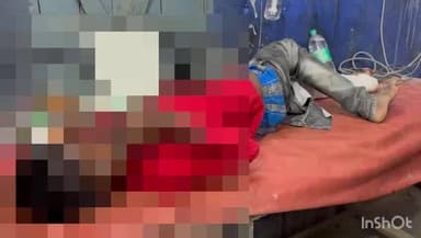 वारिसलीगंज: मिल्की गांव के पास अज्ञात गाड़ी की चपेट में आने से एक बच्चा हुआ जख्मी, बेहतर इलाज के लिए किया गया रेफर