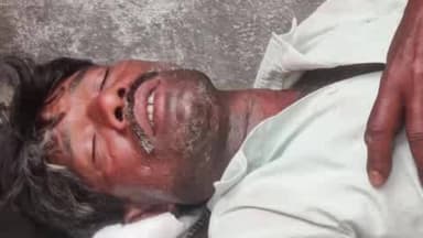 कारंजा: परसोडी शिवारात ‘आग्या’ मोहमाशांचा कहर; हल्ल्यात महिला गंभीर, आगीत होरपळून इसम जखमी