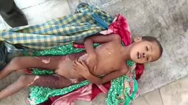 ସୁନ୍ଦରଗଡ: ବଳଦମାଲ ମୁଣ୍ଡା ପଡ଼ାରେ ଅଘଟଣ, 3 ବର୍ଷର ଶିଶୁ କନ୍ୟା ପୋଡ଼ି ମୃତ