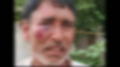 खेकड़ा: रटौल में पंचायत विवाद के बाद चाकूबाजी में 4 लोग घायल, दोनों पक्षों ने दी तहरीर, पुलिस जांच में जुटी