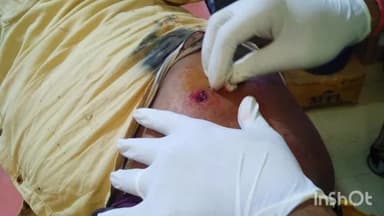 चरपोखरी: नगरी में दिनदहाड़े फायरिंग, बेलगाम अपराधियों ने सरपंच पति को मारी गोली