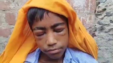 हरनौत: लोहरा गांव: चचेरी भाभी ने देवर की दोनों आँखें फोड़ी, बच्चे की हालत गंभीर, दोनों पक्षों के 7 लोगों पर मुकदमा दर्ज