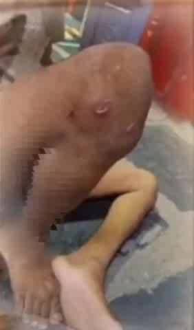 తాడిపత్రి: తాడిపత్రిలోని గాంధీ నగర్ లో స్వైర విహారం చేస్తున్న కుక్కలు, కుక్కల దాడిలో వ్యక్తికి తీవ్ర గాయాలు