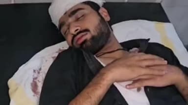 मंदसौर: खानपुरा नीलगर मोहल्ले में पीछा करने की शंका पर तीन लोगों ने युवक को लाठी-डंडों से पीटा