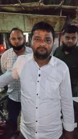 ગોધરા: કાલાભાઈ પેટ્રોલ પંપ પાસે સર્કલ હટાવતા વધ્યા અકસ્માત, સ્થાનિકોની ફરી સર્કલ બનાવવાની માંગ