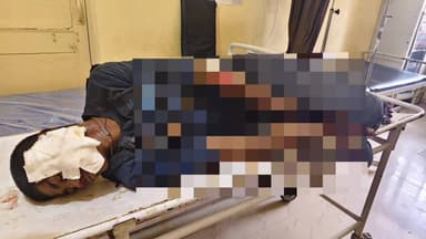 ಸೂಪಾ: ಉಳವಿ ರಸ್ತೆಯ ಕಾನೇರಿ ಸೇತುವೆಯ ಹತ್ತಿರ ಟ್ಯಾಕ್ಸಿ ಮತ್ತು ದ್ವಿಚಕ್ರ ವಾಹನದ ನಡುವೆ ಅಪಘಾತ : ದ್ವಿಚಕ್ರ ವಾಹನದ ಸವಾರ ಗಂಭೀರ