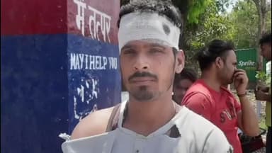 बड़ौत: किरठल में दरवाजा लगाने को लेकर विवाद में 1 युवती सहित 3 लोग घायल, 2 को हायर सेंटर रेफर किया गया