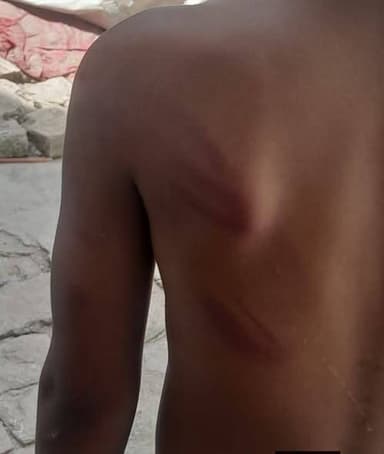 बेगूसराय जिले के चेरिया बरियारपुर प्रखंड के स्वर्ण भारतीय शिक्षण संस्थान, करोङ खाँजहाँपुर में बच्चों की पिटाई का मामला ब...