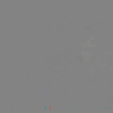 18 यूनिट इंसुलिन और 8 दवाइयां लेने वाले मरीज को 72 घंटे में मिला बड़ा फायदा
Helpline Number : 9312286540
#drbrc #Drbis...