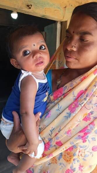 संजीनी बरकड़े के होठों पर लौटी मुस्कान
एक सफल उपचार की प्रेरक कहानी
जिले के ग्रामीण क्षेत्र से एक ऐसी प्रेरक सफलता की क...