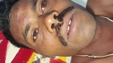 बिजावर: झरकुआ में एक व्यक्ति ने फांसी लगाकर आत्महत्या की, गंभीर हालत में जिला अस्पताल में भर्ती