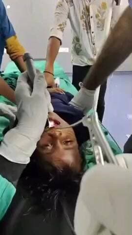 पानसेमल: बड़वानी: खेल में 2 साल की ओसाडा के गले में फंसा हेयर क्लिप, डॉक्टर ने दूरबीन से निकाला