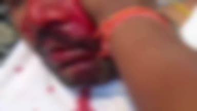 कांके: रांची: पहाड़ी मंदिर के पीछे बाउंड्री वॉल को लेकर बवाल, युवक घायल, पुलिस पहुंची