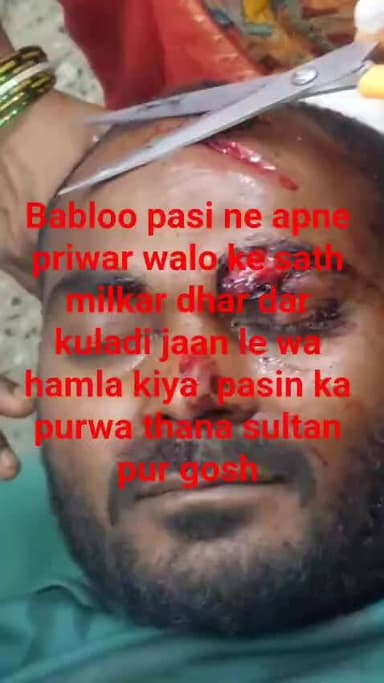 Bablu pasi ne aur apne pariwar ke sath dhar dar kulhadi se war Kiya pta pasin ka purwa thana sultan pur ghosh fatehpur