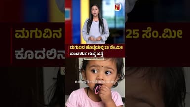 ಮಗುವಿನ ಹೊಟ್ಟೆಯಲ್ಲಿ 25 ಸೆಂ.ಮೀ ಕೂದಲಿನ ಗುಡ್ಡೆ ಪತ್ತೆ #Baby #Pica #MedicoverHospital #Bengaluru