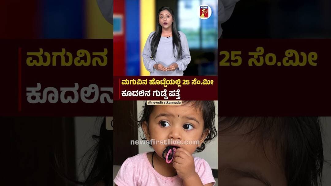 ಮಗುವಿನ ಹೊಟ್ಟೆಯಲ್ಲಿ 25 ಸೆಂ.ಮೀ ಕೂದಲಿನ ಗುಡ್ಡೆ ಪತ್ತೆ #Baby #Pica #MedicoverHospital #Bengaluru