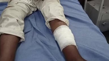 सवाई माधोपुर: सवाई माधोपुर के टोड़रा में सीमेंट फैक्ट्री के बाहर लेपर्ड के हमले में सुरक्षा गार्ड घायल