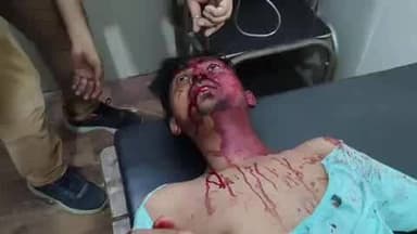 is ladke ko phone se bula kar ghar me mara gaya aur adhmara kar choda gaya lekin hasvar pulis ab Tak fir li likhi hai