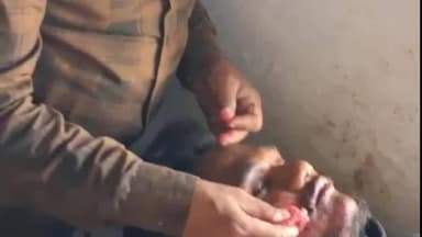 छपारा: छपारा में दो मोटरसाइकिलों की ज़ोरदार भिड़ंत, दोनों चालक गंभीर रूप से घायल
