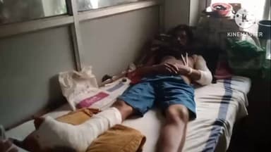 नागौद: जसो पुलिस पर युवक से बर्बर मारपीट का आरोप, युवक ने एसपी से की शिकायत